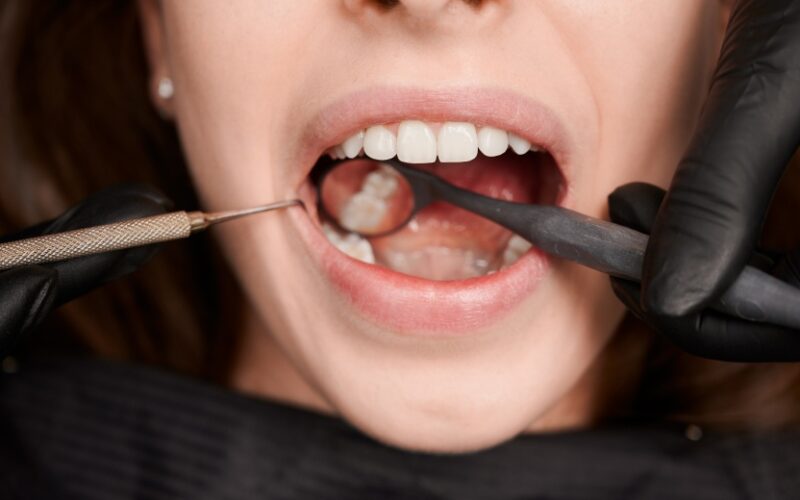 Déchaussement dentaire : que faire ? | Dr Elhyani | Paris