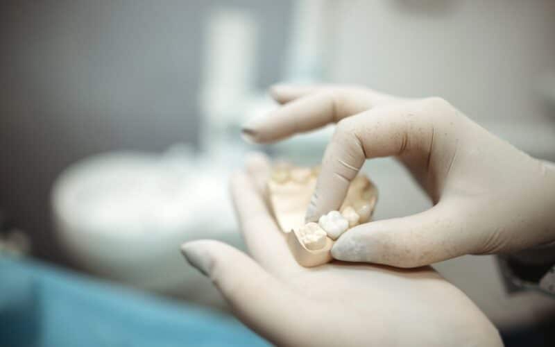 Combien de temps dure une couronne dentaire ? | Dr Elhyani | Paris